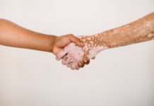 O vitiligo é uma patologia que traz consigo muitos estigmas e preconceitos, tanto de seu portador quanto das pessoas à sua volta. A doença acometeu o astro do pop Michael Jackson