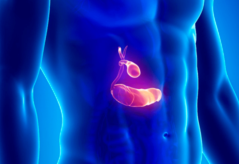 Quais os tratamentos para pedra na vesícula?